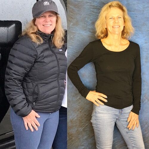 Shelly-Before-&-After