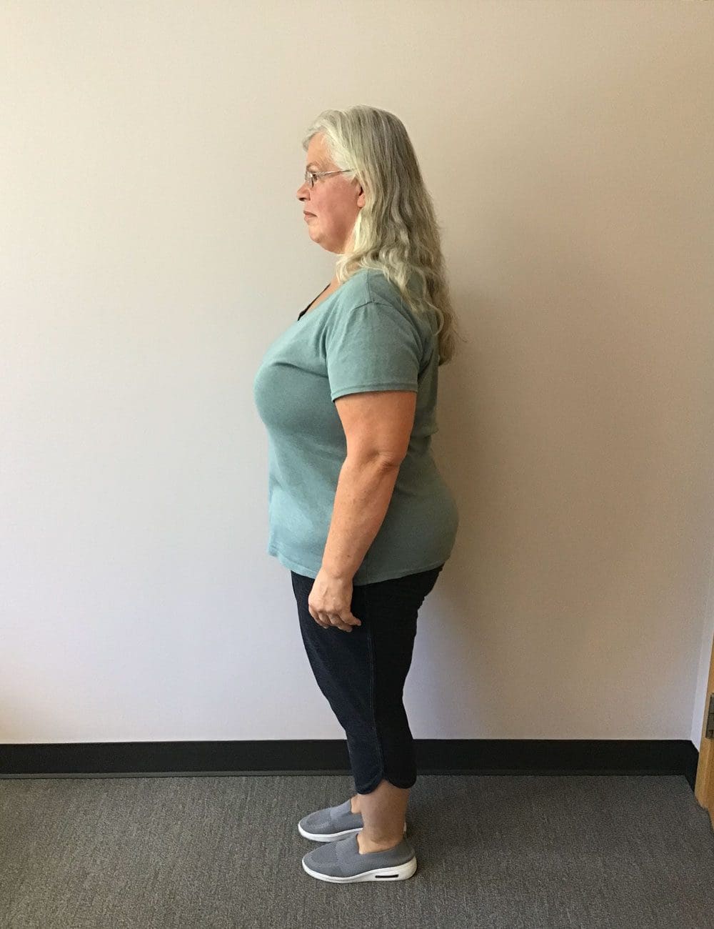 Lynnette after