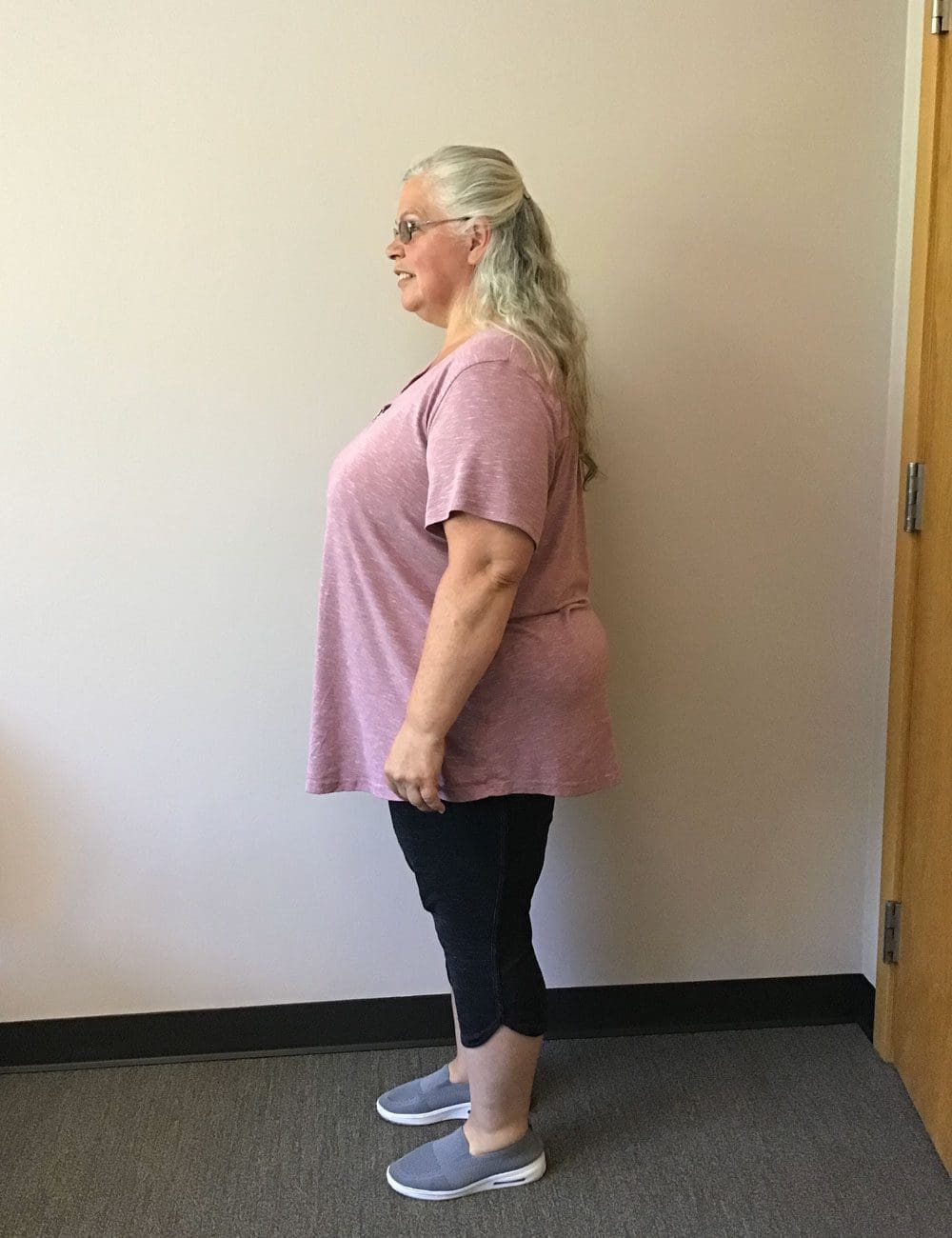 Lynnette before